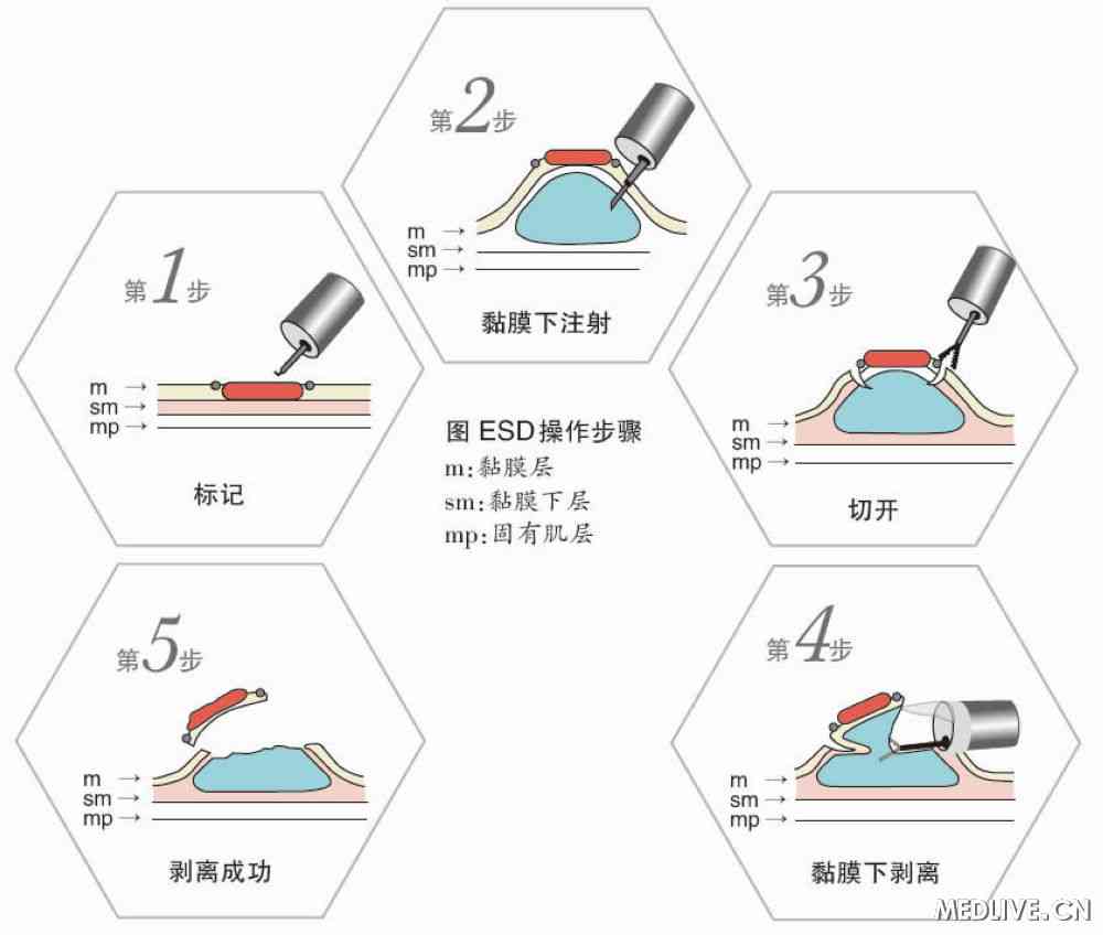 必一