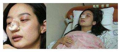 “b体育”
她是娱乐圈最惨女星 完婚13天却仳离 还遭丈夫家暴到流产！(图8)